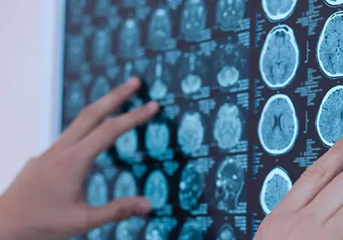 neurologia veterinaria