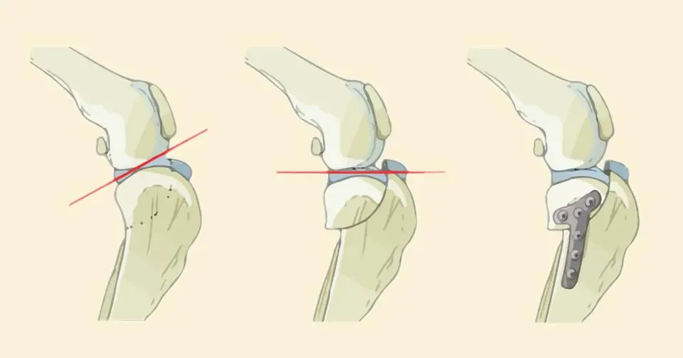 ortopedia tplo